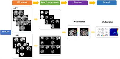 Mapping white matter structural and network alterations in betel quid-dependent chewers using high angular resolution diffusion imaging